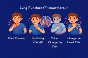Lung puncture symptoms explained visually