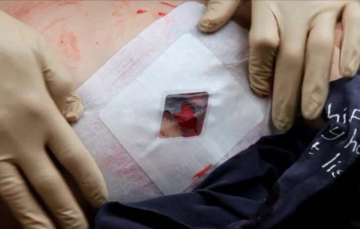 Gunshot Wound to the Chest: Emergency Awareness and First Aid Priorities